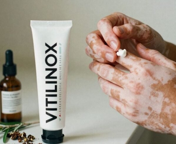 Vitilinox: A Natural Vitiligo Treatment in 2026